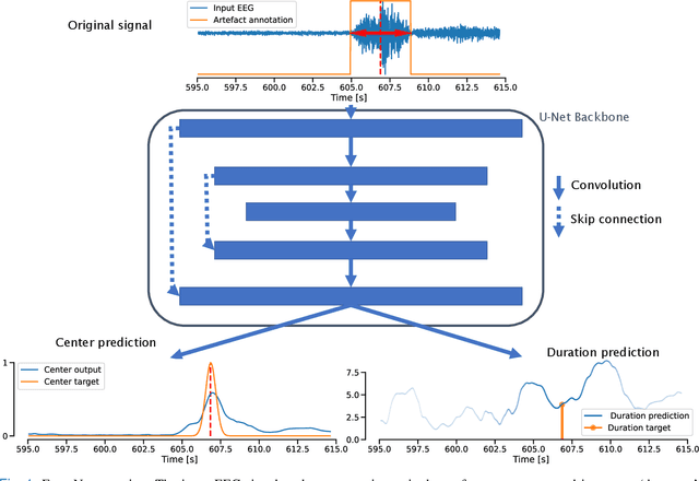 Figure 1 for EventNet: Detecting Events in EEG