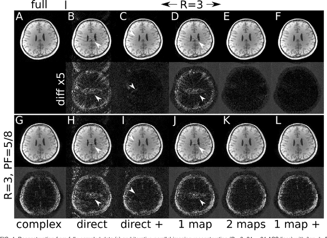 Figure 4 for Estimating Absolute-Phase Maps Using ESPIRiT and Virtual Conjugate Coils