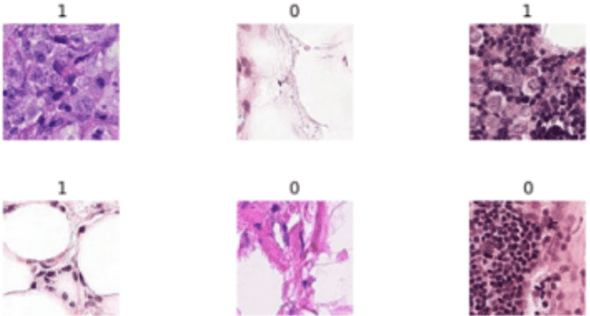 Figure 1 for Cancer image classification based on DenseNet model