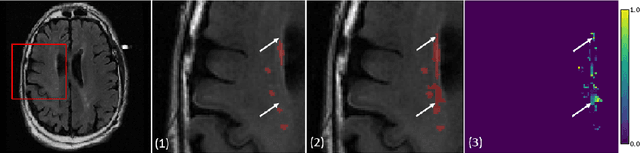 Figure 1 for STRUDEL: Self-Training with Uncertainty Dependent Label Refinement across Domains