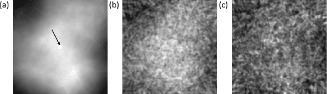 Figure 1 for Investigating the limited performance of a deep-learning-based SPECT denoising approach: An observer-study-based characterization