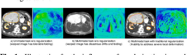 Figure 1 for Unimodal Cyclic Regularization for Training Multimodal Image Registration Networks