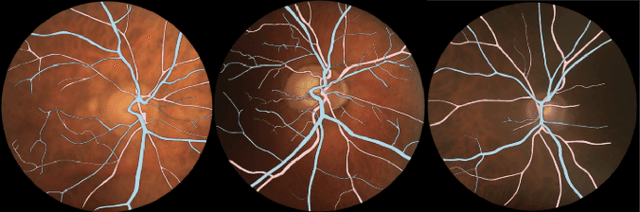 Figure 4 for Lirot.ai: A Novel Platform for Crowd-Sourcing Retinal Image Segmentations