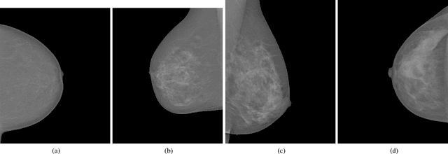 Figure 1 for Classifying Mammographic Breast Density by Residual Learning