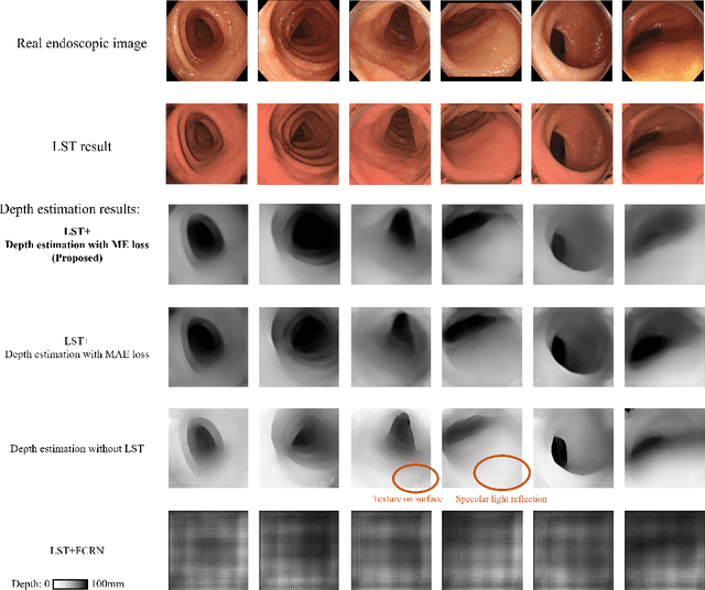 Figure 3 for Depth Estimation from Single-shot Monocular Endoscope Image Using Image Domain Adaptation And Edge-Aware Depth Estimation