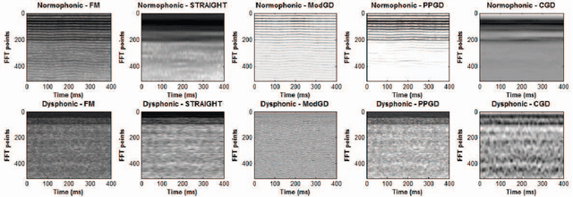 Figure 1 for Phase-based Information for Voice Pathology Detection