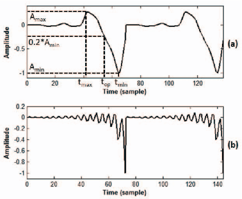 Figure 3 for Phase-based Information for Voice Pathology Detection