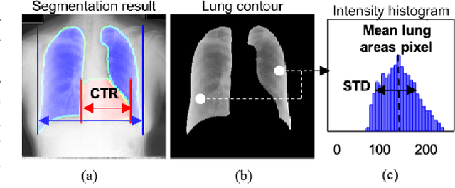 Figure 3 for Deep Learning COVID-19 Features on CXR using Limited Training Data Sets