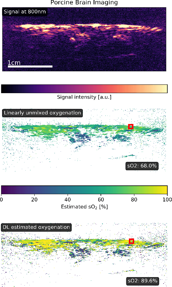 Figure 4 for Estimation of blood oxygenation with learned spectral decoloring for quantitative photoacoustic imaging (LSD-qPAI)