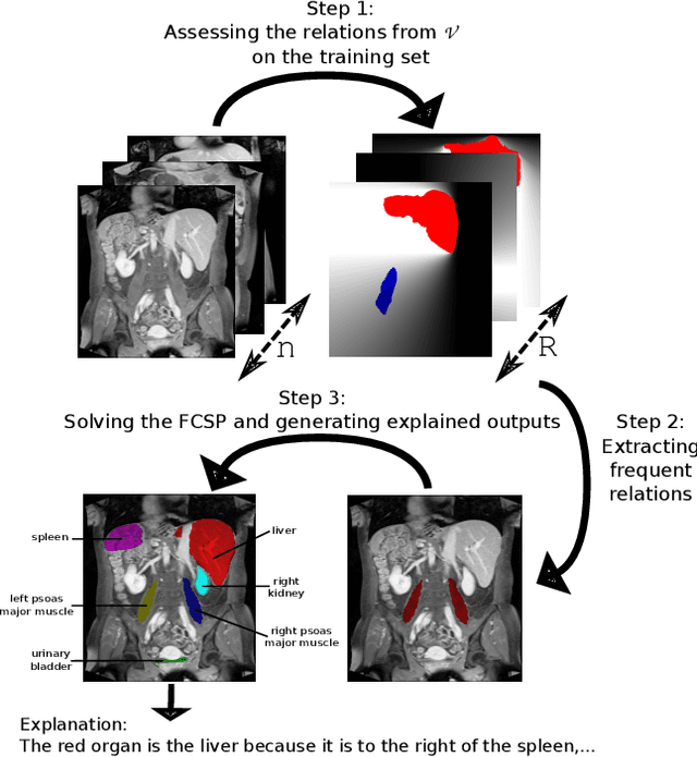 Figure 1 for A New Approach for Explainable Multiple Organ Annotation with Few Data