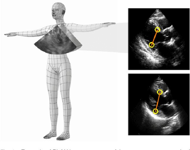 Figure 1 for Reciprocal Landmark Detection and Tracking with Extremely Few Annotations