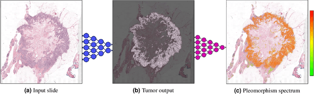 Figure 1 for Automated Scoring of Nuclear Pleomorphism Spectrum with Pathologist-level Performance in Breast Cancer