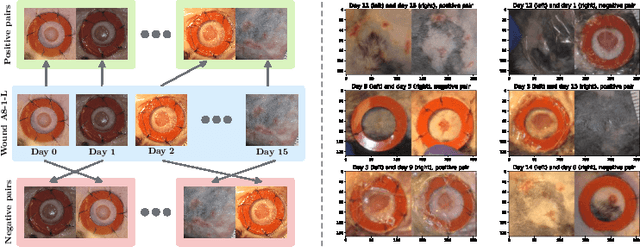 Figure 3 for HealNet -- Self-Supervised Acute Wound Heal-Stage Classification