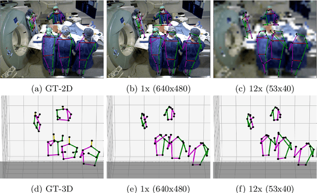 Figure 3 for Self-supervision on Unlabelled OR Data for Multi-person 2D/3D Human Pose Estimation