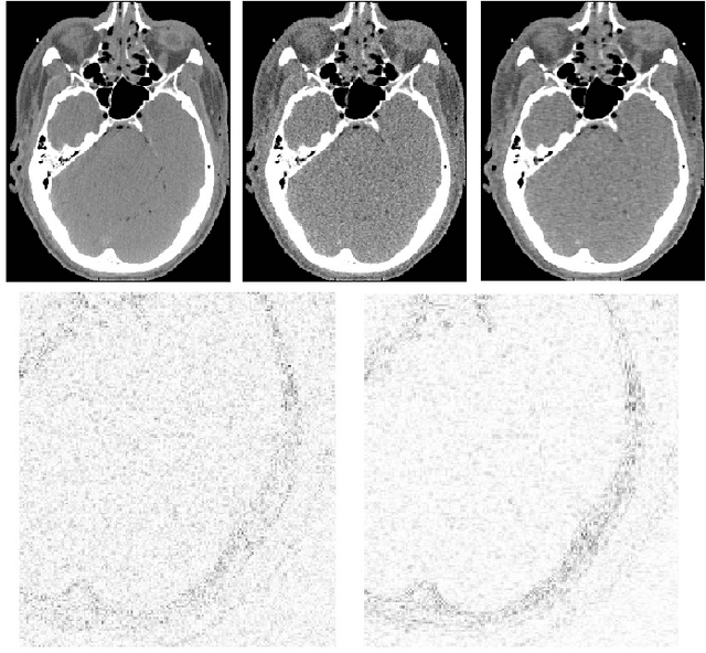 Figure 2 for Spatially-Adaptive Reconstruction in Computed Tomography using Neural Networks