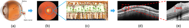 Figure 1 for A self-training framework for glaucoma grading in OCT B-scans