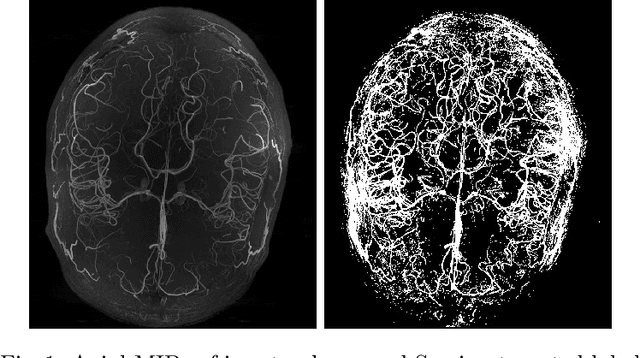 Figure 1 for DS6: Deformation-aware learning for small vessel segmentation with small, imperfectly labeled dataset