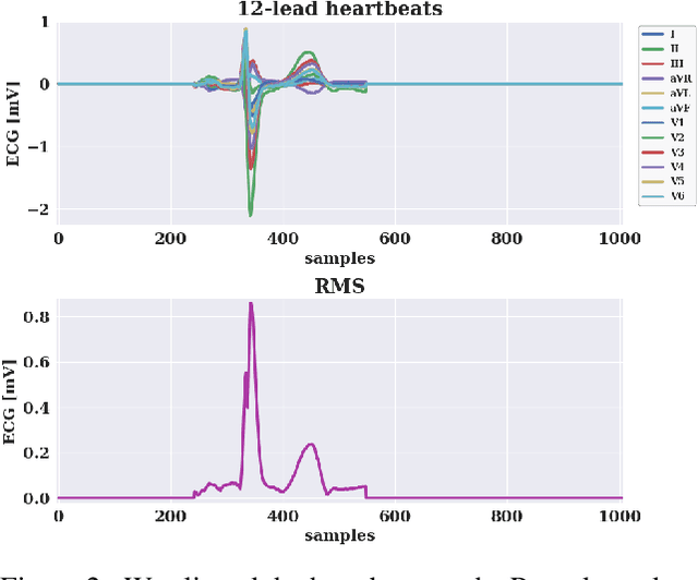 Figure 3 for Generative Pre-Trained Transformer for Cardiac Abnormality Detection