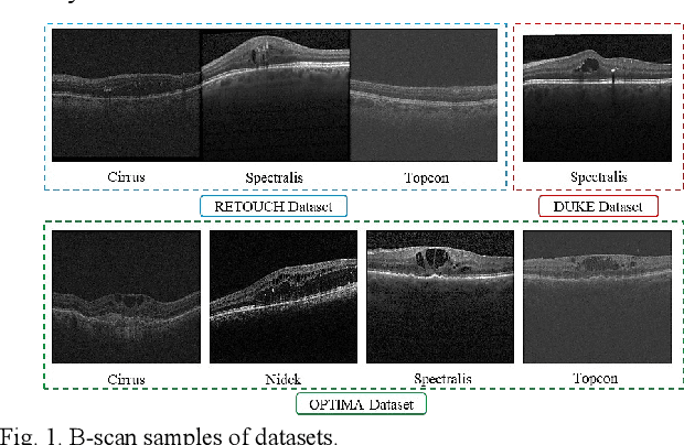 Figure 2 for RetiFluidNet: A Self-Adaptive and Multi-Attention Deep Convolutional Network for Retinal OCT Fluid Segmentation