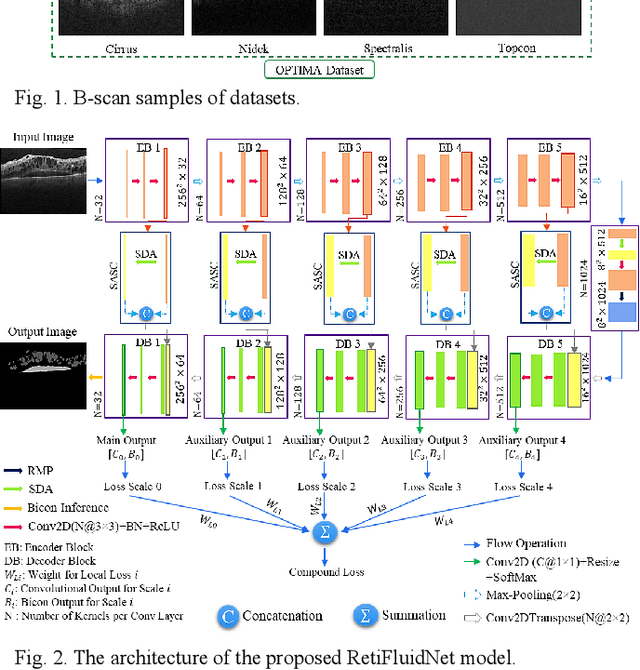 Figure 4 for RetiFluidNet: A Self-Adaptive and Multi-Attention Deep Convolutional Network for Retinal OCT Fluid Segmentation