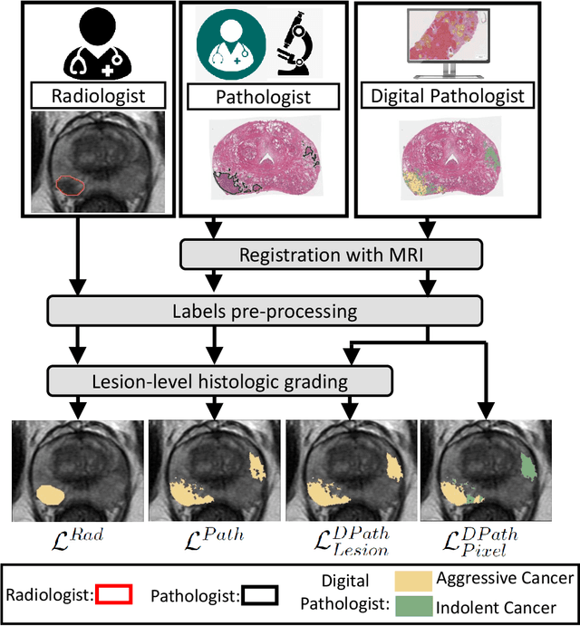 Figure 2 for Bridging the gap between prostate radiology and pathology through machine learning