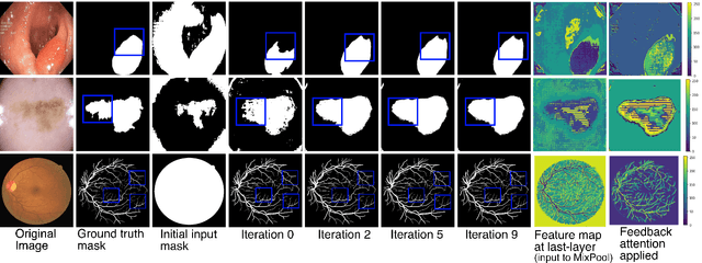 Figure 1 for FANet: A Feedback Attention Network for Improved Biomedical Image Segmentation