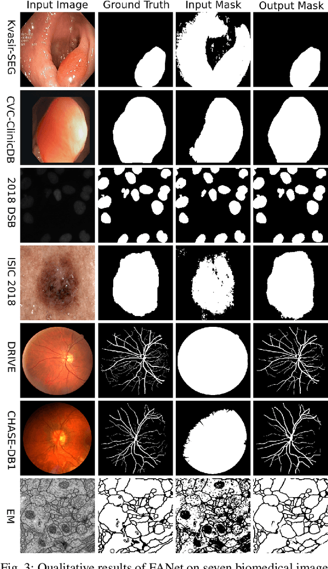 Figure 3 for FANet: A Feedback Attention Network for Improved Biomedical Image Segmentation