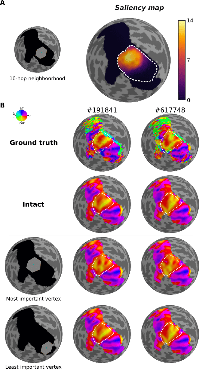 Figure 2 for An explainability framework for cortical surface-based deep learning