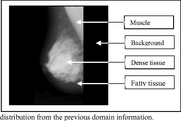 Figure 3 for A combined Approach Based on Fuzzy Classification and Contextual Region Growing to Image Segmentation