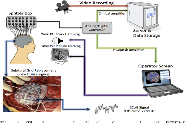 Figure 1 for Automatic Response Assessment in Regions of Language Cortex in Epilepsy Patients Using ECoG-based Functional Mapping and Machine Learning
