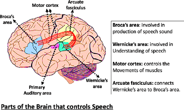 Figure 2 for Automatic Response Assessment in Regions of Language Cortex in Epilepsy Patients Using ECoG-based Functional Mapping and Machine Learning