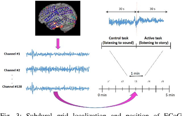 Figure 3 for Automatic Response Assessment in Regions of Language Cortex in Epilepsy Patients Using ECoG-based Functional Mapping and Machine Learning