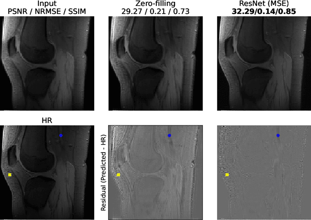 Figure 1 for Towards Super-Resolution CEST MRI for Visualization of Small Structures