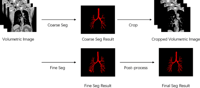 Figure 1 for Extraction of Pulmonary Airway in CT Scans Using Deep Fully Convolutional Networks