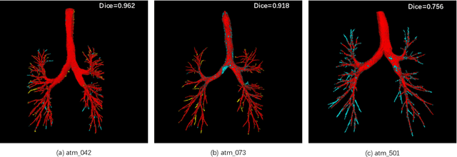 Figure 4 for Extraction of Pulmonary Airway in CT Scans Using Deep Fully Convolutional Networks