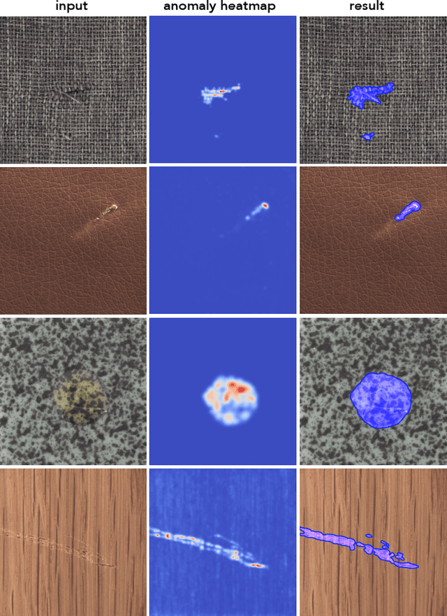 Figure 1 for Self-Supervised Training with Autoencoders for Visual Anomaly Detection