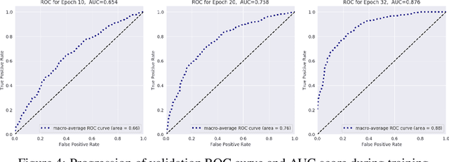 Figure 4 for 3D Neural Network for Lung Cancer Risk Prediction on CT Volumes