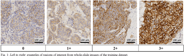 Figure 1 for Learning Where to See: A Novel Attention Model for Automated Immunohistochemical Scoring