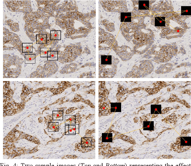 Figure 4 for Learning Where to See: A Novel Attention Model for Automated Immunohistochemical Scoring