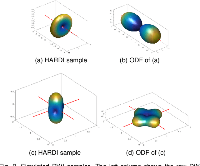 Figure 2 for Information-Theoretic Registration with Explicit Reorientation of Diffusion-Weighted Images