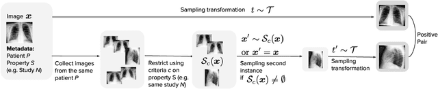 Figure 1 for MedAug: Contrastive learning leveraging patient metadata improves representations for chest X-ray interpretation