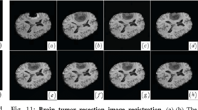 Figure 3 for Local Structure Matching Driven by Joint-Saliency-Structure Adaptive Kernel Regression