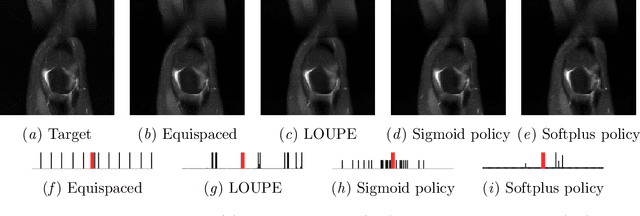 Figure 4 for On learning adaptive acquisition policies for undersampled multi-coil MRI reconstruction