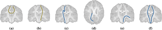 Figure 1 for Tractography filtering using autoencoders