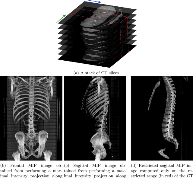 Figure 1 for Automatic L3 slice detection in 3D CT images using fully-convolutional networks