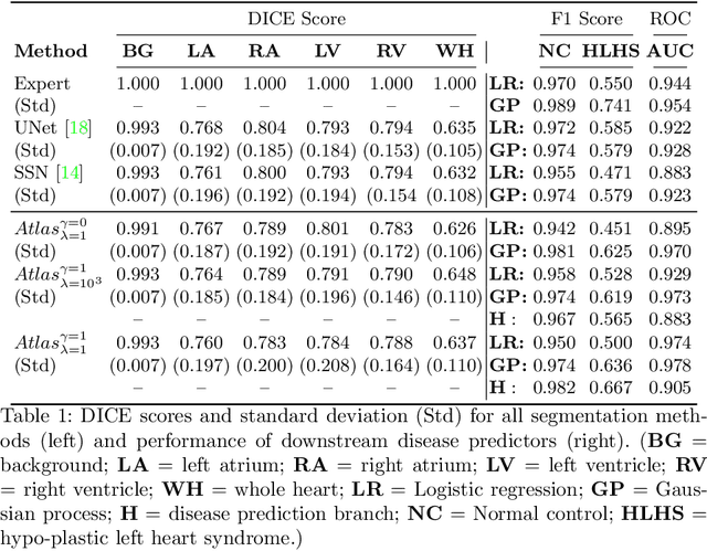 Figure 2 for Detecting Hypo-plastic Left Heart Syndrome in Fetal Ultrasound via Disease-specific Atlas Maps