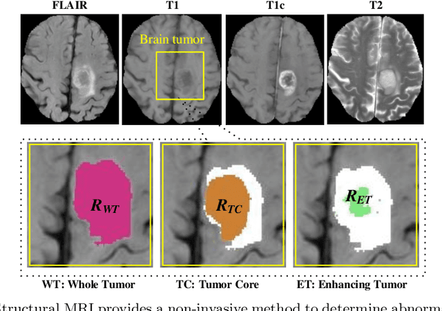 Figure 1 for Convolutional 3D to 2D Patch Conversion for Pixel-wise Glioma Segmentation in MRI Scans