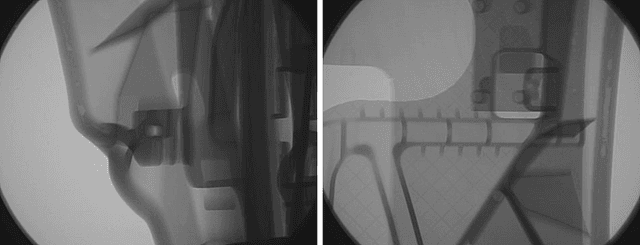 Figure 1 for Defect detection and segmentation in X-Ray images of magnesium alloy castings using the Detectron2 framework