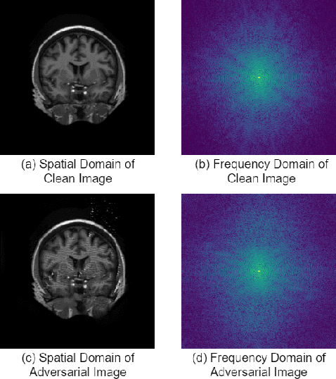 Figure 3 for Robustification of Segmentation Models Against Adversarial Perturbations In Medical Imaging