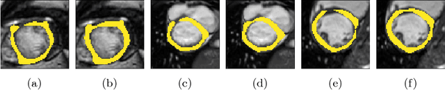 Figure 1 for Explicit topological priors for deep-learning based image segmentation using persistent homology